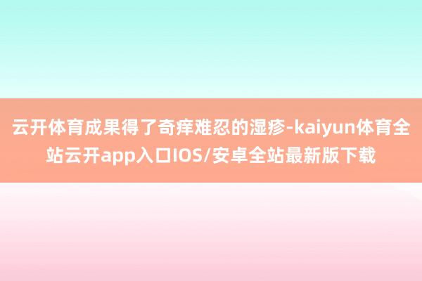 云开体育成果得了奇痒难忍的湿疹-kaiyun体育全站云开app入口IOS/安卓全站最新版下载
